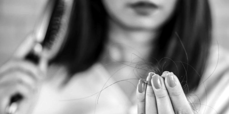 Leia mais sobre o artigo Quais são as principais causas da queda de cabelo?