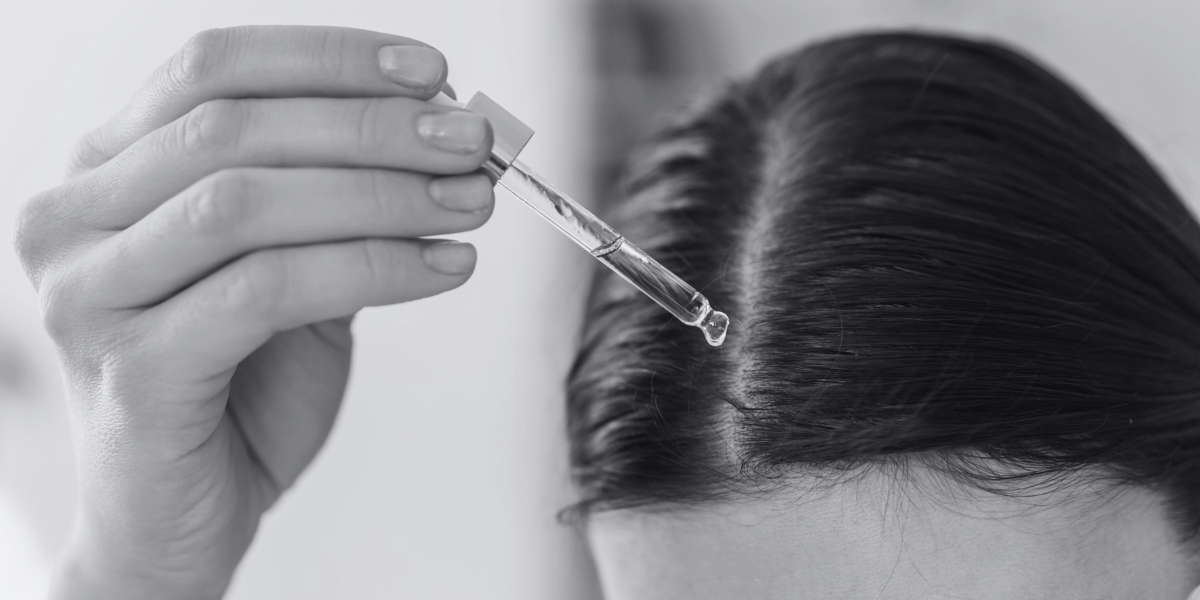 O que você precisa saber sobre o minoxidil para queda de cabelo